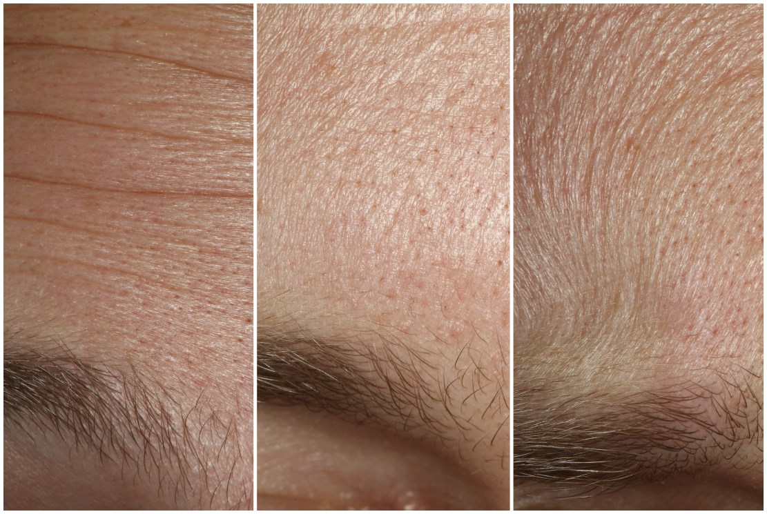 Skin Microstructure Deformation with Displacement Map Convolution